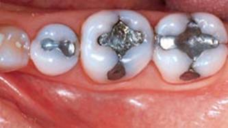 Naples Dental Implants